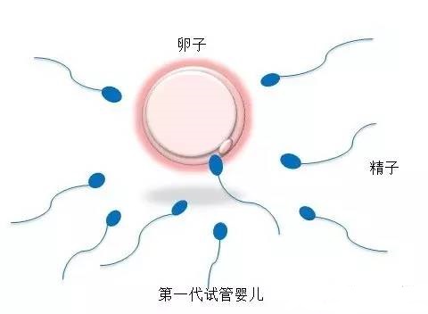 ICSI操作